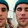 Justin Bieber confiesa cuál es la enfermedad que le provocó una parálisis facial