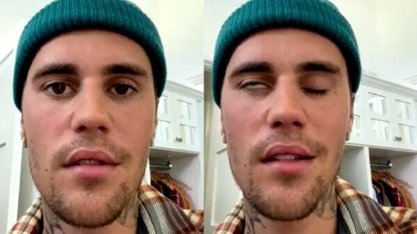 Justin Bieber confiesa cuál es la enfermedad que le provocó una parálisis facial