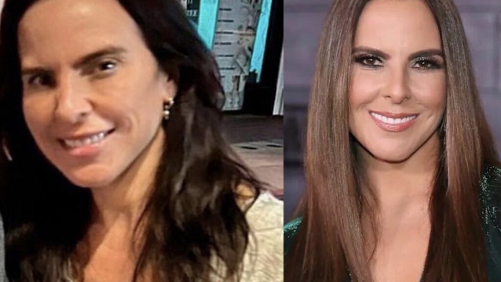 Impacta En Redes El Cambio En El Rostro De La Actriz Kate Del Castillo