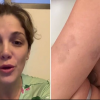 Natalia Alcocer muestra los terribles golpes que sufrió y acusa a su ex de potencial feminicida