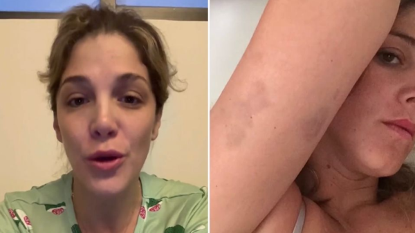 Natalia Alcocer muestra los terribles golpes que sufrió y acusa a su ex de potencial feminicida