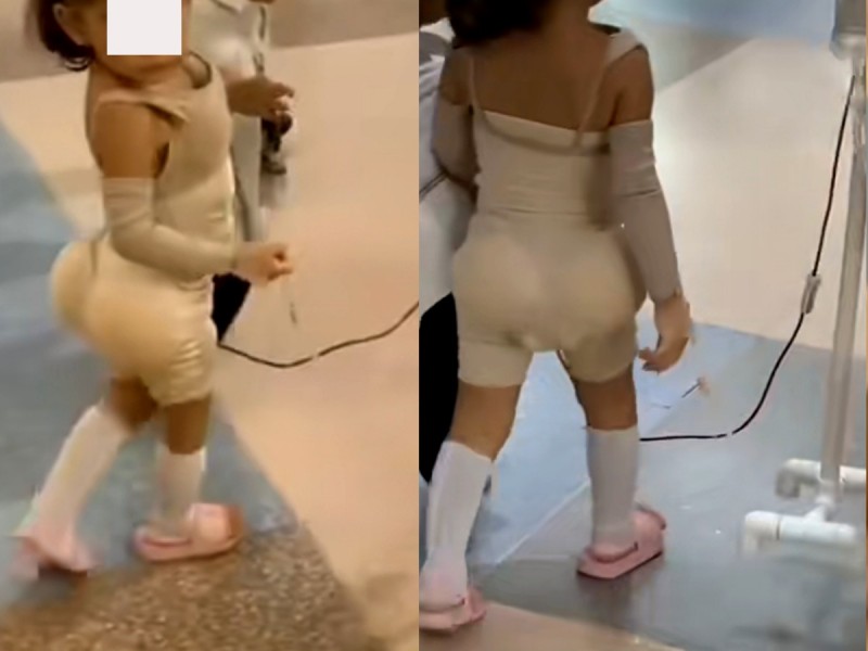 VIDEO: Disfraz de niña con cirugías estéticas en Halloween se hace viral y divide opiniones