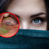 VIDEO: Mujer tenía enterrados más de 20 lentes de contacto y graban la forma en que se los retiraron