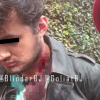 IMÁGENES FUERTES: Detienen a joven en la Álvaro Obregón tras apuñalar a su novia 17 veces