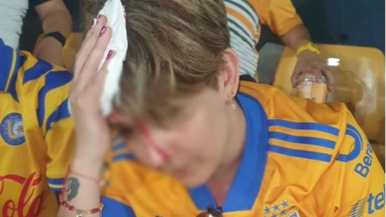 Pedazo de estadio de Tigres cae en la cabeza de una aficionada y le provoca fuerte herida