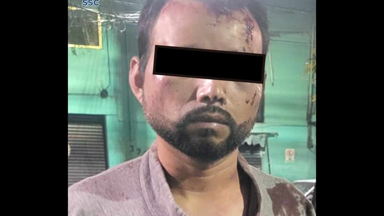 Hombre apuñala a otro sujeto con cuchillo de 40 cm tras intensa riña en la Magdalena Contreras
