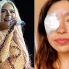 Fan de Karol G casi pierde el ojo en pleno concierto