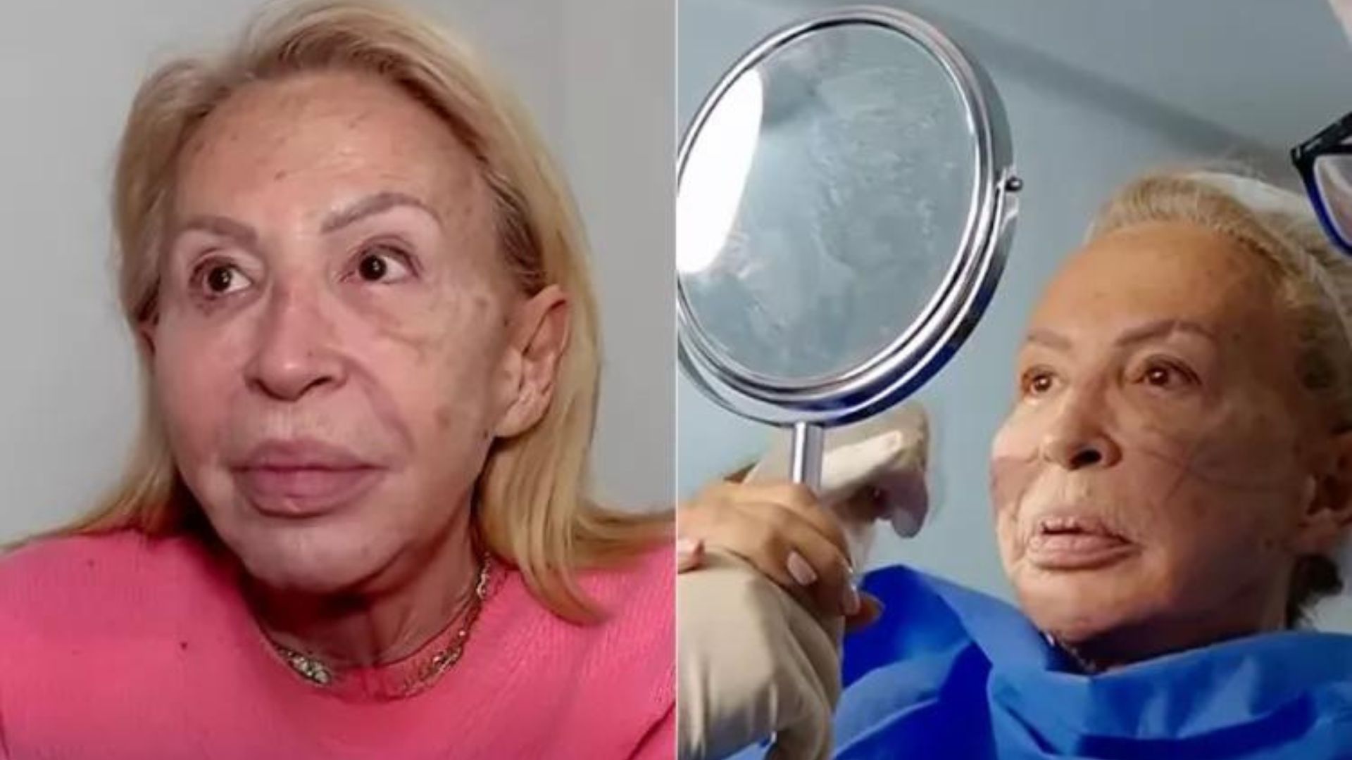 Laura Bozzo se Sometió a Tratamientos Estéticos