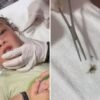 Madre graba el momento en que le sacan un cangrejo de la oreja a su hijo