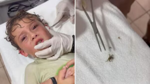 Madre graba el momento en que le sacan un cangrejo de la oreja a su hijo
