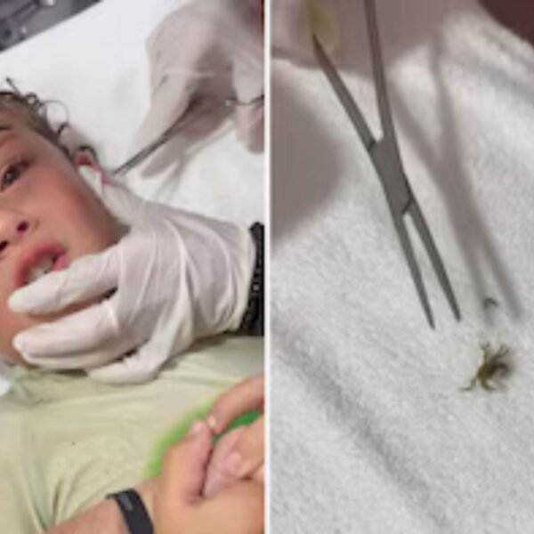Madre graba el momento en que le sacan un cangrejo de la oreja a su hijo
