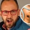 ¿Qué le pasó en la nariz a Mauricio Clark? Así fue su cirugía reconstructiva