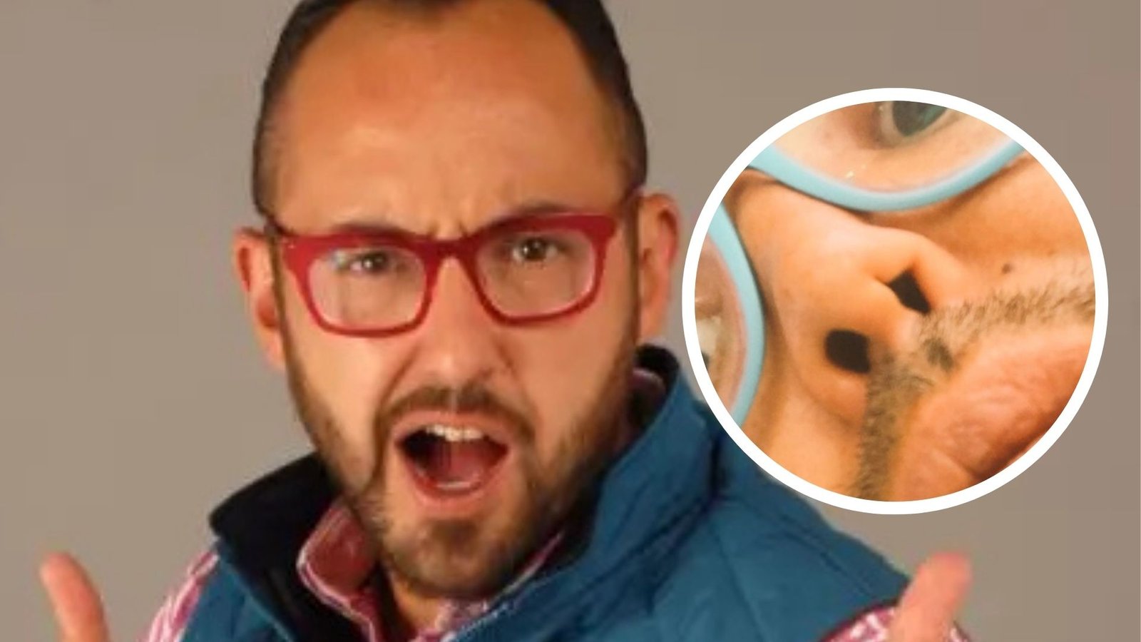 ¿Qué le pasó en la nariz a Mauricio Clark? Así fue su cirugía reconstructiva