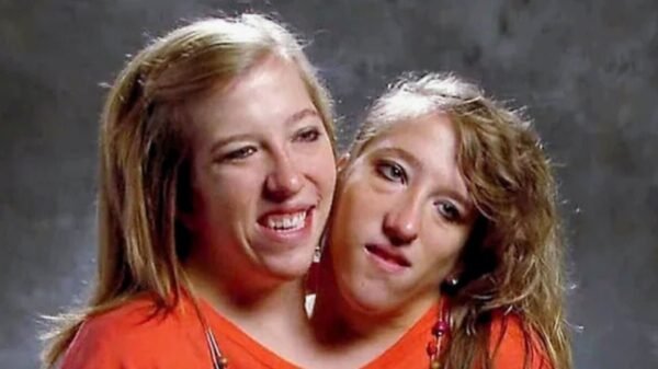 Abby y Brittany Hensel, las siamesas más famosas del mundo, reaparecen a los 35 años y ¿con un bebé?