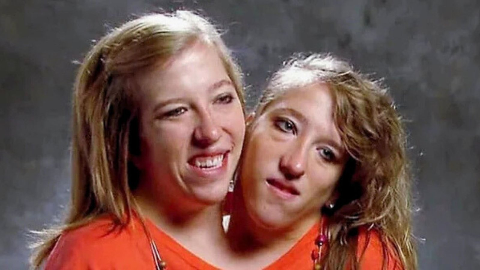 Abby y Brittany Hensel, las siamesas más famosas del mundo, reaparecen a los 35 años y ¿con un bebé?