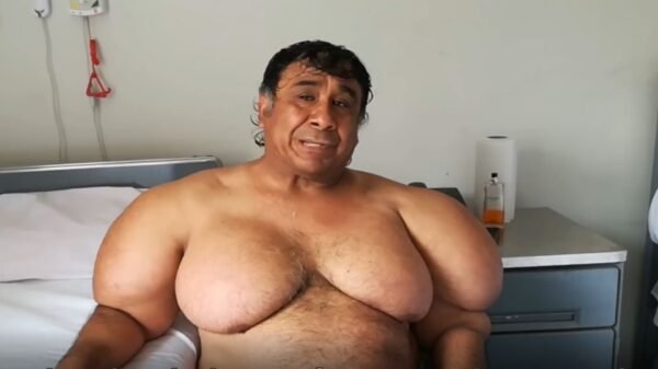 ¿Quién es Alejandro Ramos? El buzo peruano que quedó deformado por un accidente submarino