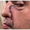 Exintegrante de Molotov, Tito Fuentes, enfrenta recuperación tras 11 cirugías por adicciones