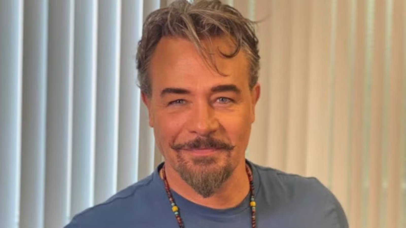 ¿Cuánto cuesta el tratamiento al que se sometió Sergio Sendel para lucir más joven?