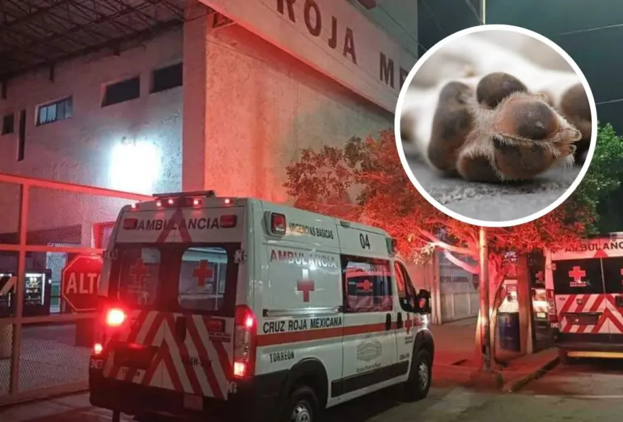 Perro ataca brutalmente adulta mayor y le amputa parcialmente el pie en Torreón, Coahuila