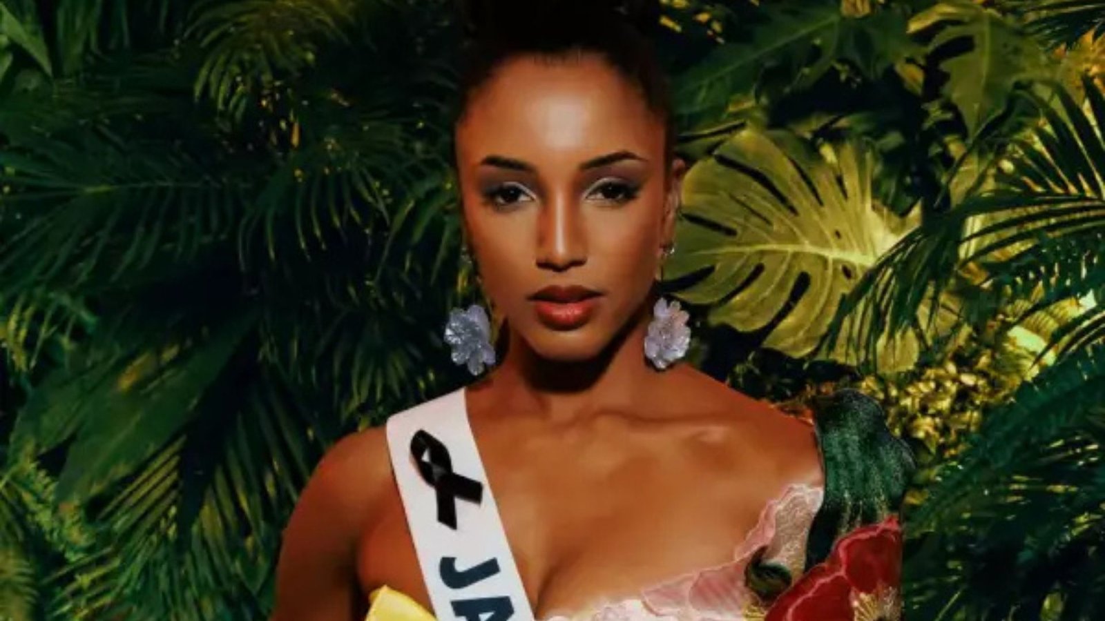 Miss Jamaica en estado delicado: confirman daño cerebral, fractura y traslado urgente