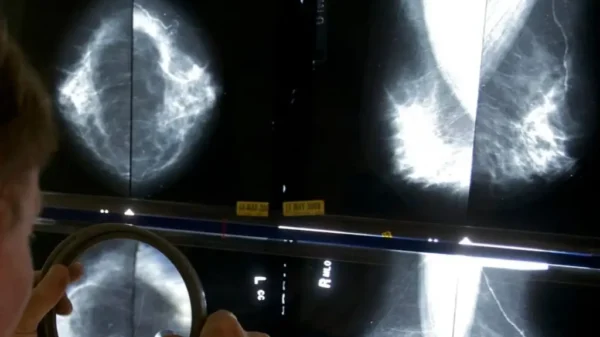 Entra en vigor reforma que elimina la prioridad legal a enfermedades de alto costo como el cáncer