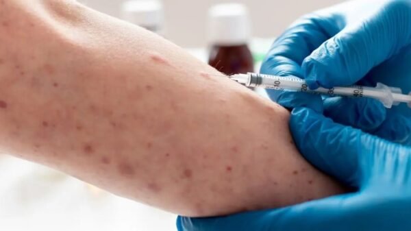 México registra 7 mil 131 casos de sarampión; Salud mantiene brigadas de vacunación