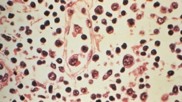 ¿Hay riesgo de hantavirus en México? Salud confirma vigilancia activa en el país