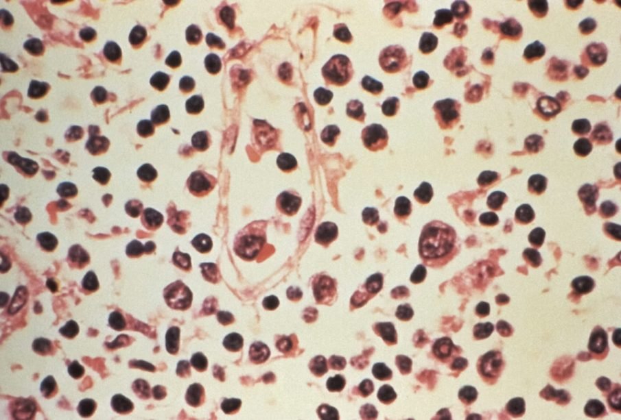 ¿Hay riesgo de hantavirus en México? Salud confirma vigilancia activa en el país
