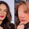 Yolanda Andrade revela nueva enfermedad tras confirmar que tiene ELA y un aneurisma