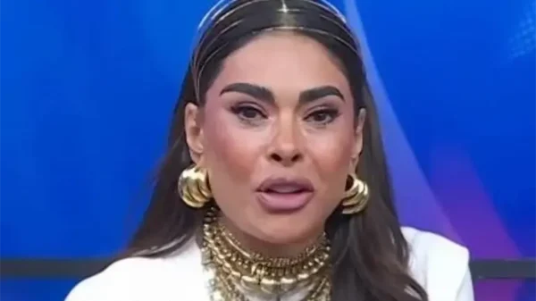 ¿Tiene chueca la cara? Galilea es atacada por cambios en su rostro