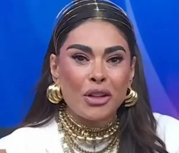¿Tiene chueca la cara? Galilea es atacada por cambios en su rostro