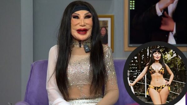 Lyn May rompe el silencio y explica por qué cambió su rostro para siempre