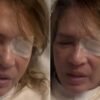 Yolanda Andrade reaparece entre el dolor y alarma a sus seguidores con impactante video