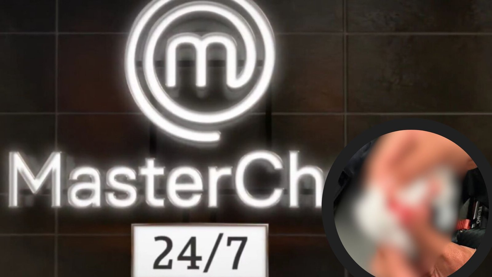 Participante de MasterChef se corta el dedo con un cuchillo y el video de cómo quedó impacta