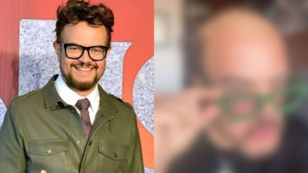 Aleks Syntek muestra su cabeza sin peluquín y anuncia una inesperada rifa