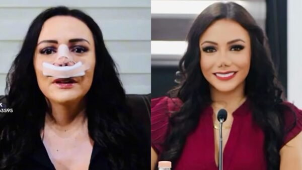 Carolina Guevara revela qué ocurrió con su nariz tras los comentarios en redes