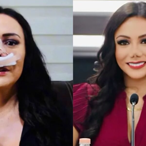 Carolina Guevara revela qué ocurrió con su nariz tras los comentarios en redes